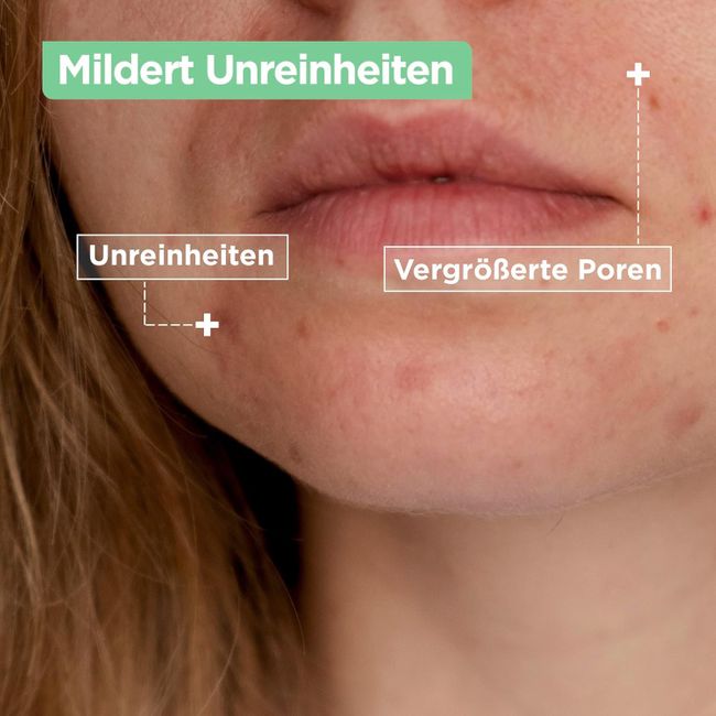 Mixa Anti Unreinheiten Comfort Cleanser