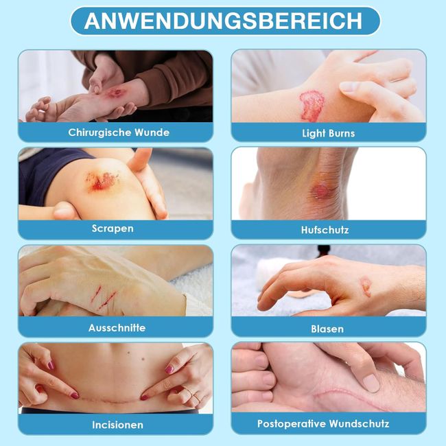 PimpleGuard Hydrocolloid Roll Blasenpflaster Wasserfest