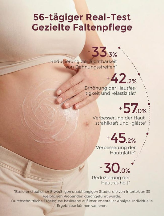 Momcozy Schwangerschaftscreme Dehnungsstreifen Vorbeugung