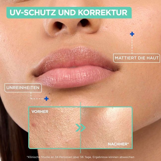 Mixa Tägliches UV Fluid LSF50+ Anti Unreinheiten