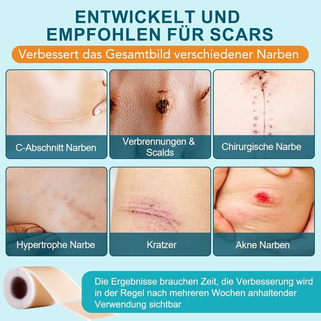 HUALIJIA Silikon Narbenpflaster für die Haut
