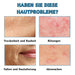 SUMMISHI Micro Infusion System: Microneedling Roller