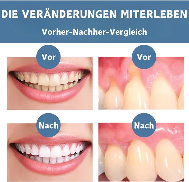 SUMMISHI Zahnfleisch Reparatur Spray & Tropfen