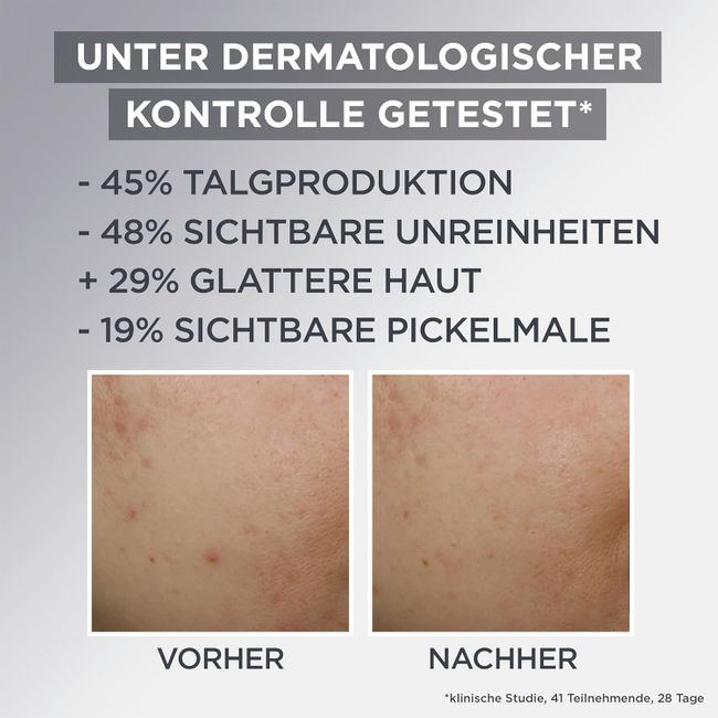 Garnier SkinActive AHA+BHA mit Kohle Gesichtscreme