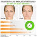 Abodiuss Vitamin C Serum Gesicht