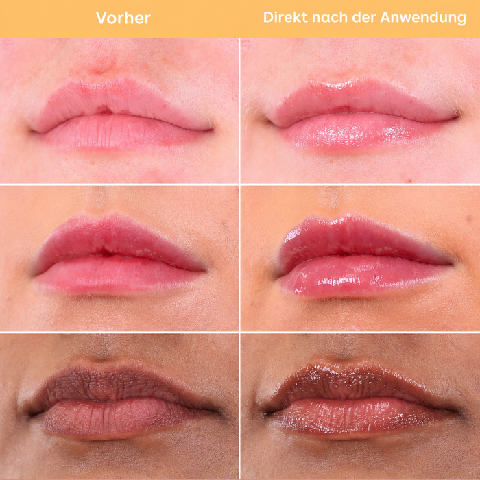 Q+A Super Food Lippenbalsam