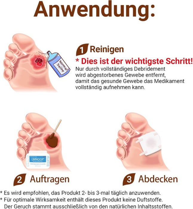 LMNOOP Wundliegen Creme Wundheilungssalbe