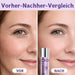 SUMMISHI NAD + PDRN Lifting Essence