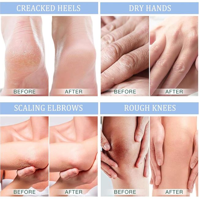 AONAT Urea Creme 40 Prozent