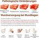 LMNOOP Dekubitus Creme Wundheilungssalbe