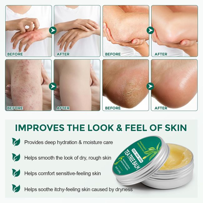 Abodiuss Teebaumöl Creme & Pflegebalsam