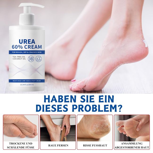 SUMMISHI Urea Creme 60 Prozent