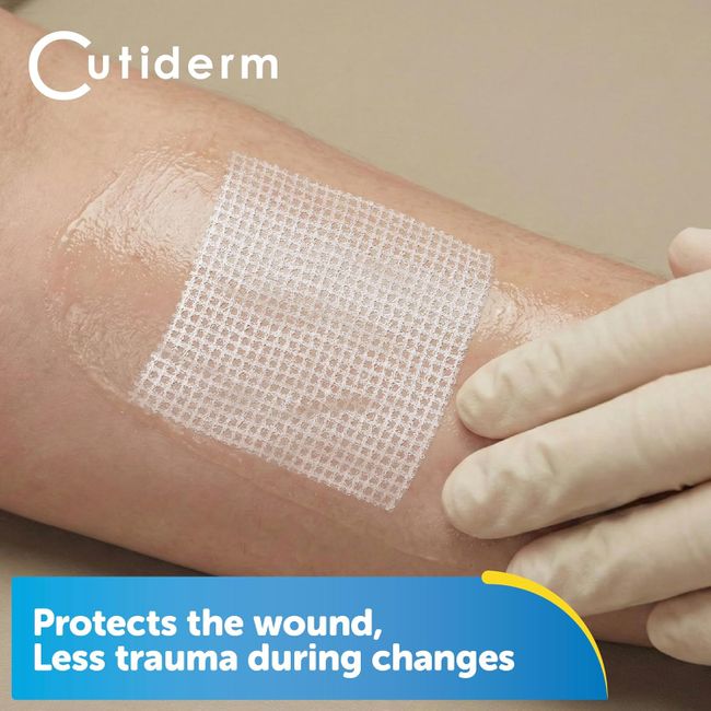 Cutiderm sterile Paraffingaze-Kompresse 5 cm x 5 cm