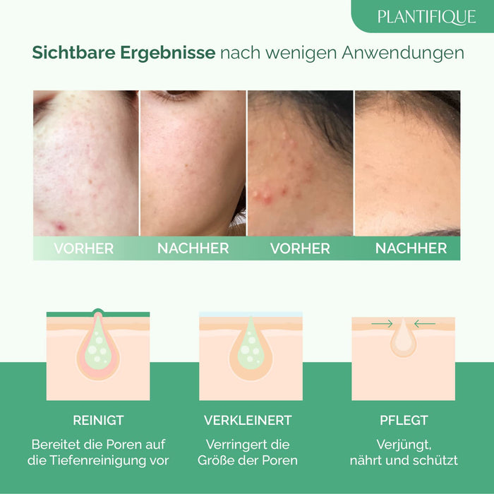 Korean Gesichtsmaske mit Avocado & Superfoods 100ml - Gesicht Polierer aus Meereslehm - Gesichtsporen - Minimierer - Reinigt Pickel und entgiftet