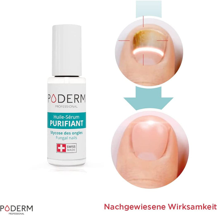 NAGELPILZ-BEHANDLUNG | Mit der Kraft antimykotischer, reparierender, reinigender und revitalisierender Pflanzen | Professionelle Fuß- und Handpflege
