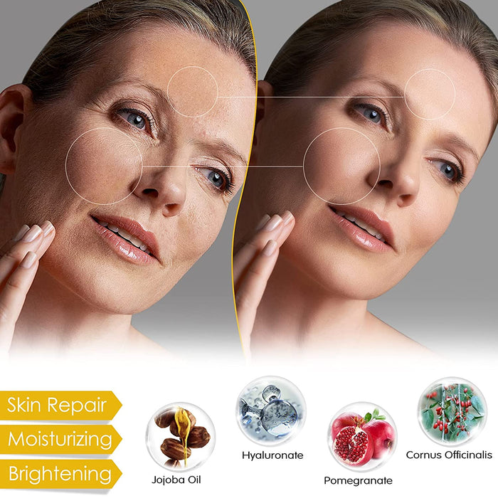 Pigmentflecken Entferner, Gesichtspflege gegen Pigmentflecken und Altersflecken, für einen ebenmäßigen & strahlenden Teint, 30 ml