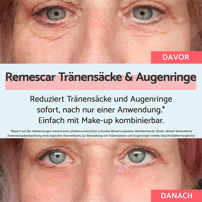 Tränensäcke und Augenringe - Creme für Tränensäcke und Augenringe - Sofort wirkende Behandlung für Männer und Frauen - Straffung der Augenpartien