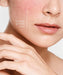 Anti-Rötungen Leichte Tagespflege, bei Rosacea, mindert Rötungen im Gesicht, als Rosacea Gesichtspflege geeignet, Rosacea Creme für das Gesicht, 50 ml
