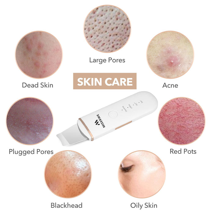 Face Skin Spatula Ultraschallpeelinggerät Skin Scrubber Mitesserentferner Porenreiniger Gesicht Schönheitspflege Gesichtslifting Werkzeug Mitesser