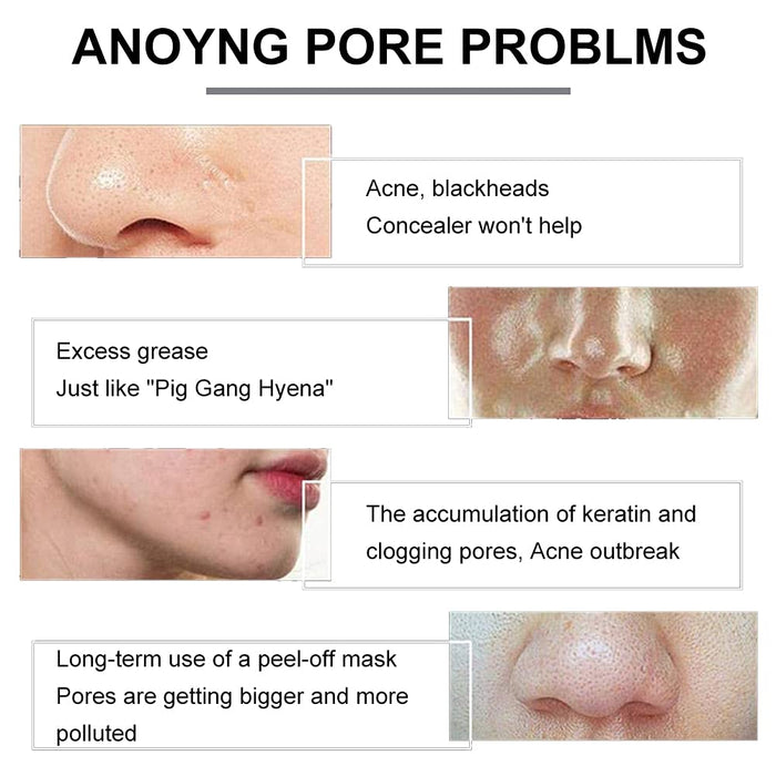 Charcoal Mask Stick, Purifying Clay Stick Mask, Clay Stick Mask, Effektiv Akne entfernt Mitesser, Verkleinert die Poren, Strafft die Haut