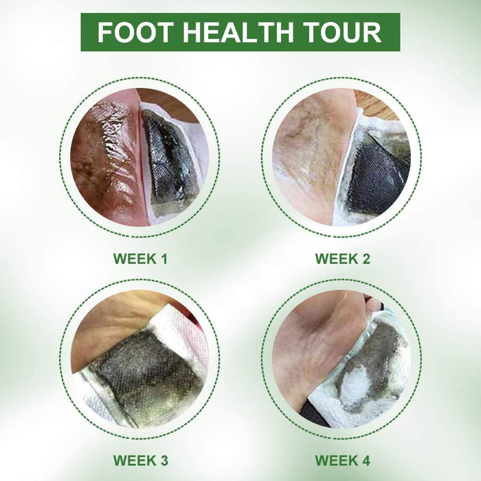 Detox Fußpflaster Vitalpflaster Fusspflaster Wormwood Foot Patch Fördern die Durchblutung, Lindern Schmerzen und Verbessern den Schlaf